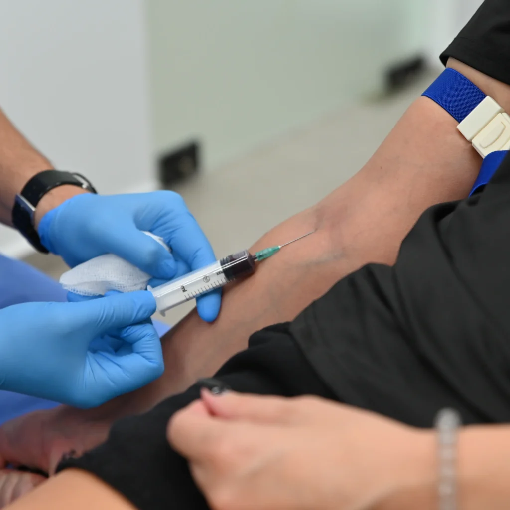 ληψη αιματος, PRP, θεραπεία αρθρίτιδα, θεραπεία χονδροπάθειες, θεραπεία μυικές θλάσεις, θεραπεια με αιμοπετάλια