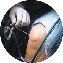 arthroskopisi-gonato-modern-orthopedics-orthopedikos-larisa