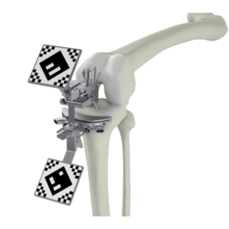 Modern Orthopedics,γεώργιος χαλάτσης,ορθοπαιδικός λάρισα,ορθοπεδικος λαρισα,ορθοπαιδικοι λαρισα Modern Orthopedics Γεώργιος Χαλάτσης Ορθοπαιδικός Χειρουργός, Λάρισα pixee robotiki xeirourgiki xalatsis orthopedikos larisa 3